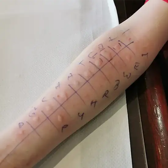 allergy fruit panel-1